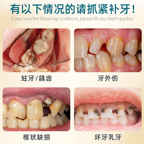 深圳同步齒科點樣呀？睇牙口碑好又唔貴，香港人嚟深圳睇牙拣同步齒科就啱晒啦！！