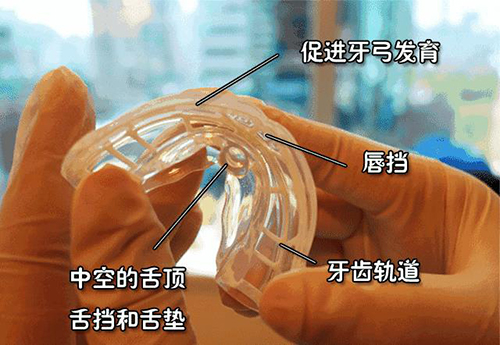 牙齿矫正早期肌功能矫正器_5