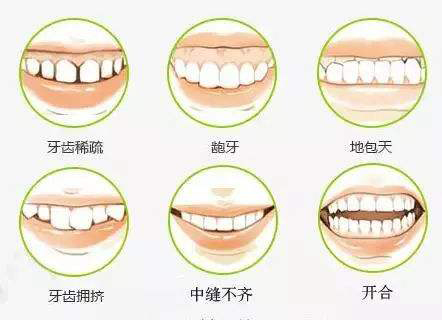 港人喺深圳整牙要几多钱呀？睇下2025年深圳整牙嘅收费准则呀！