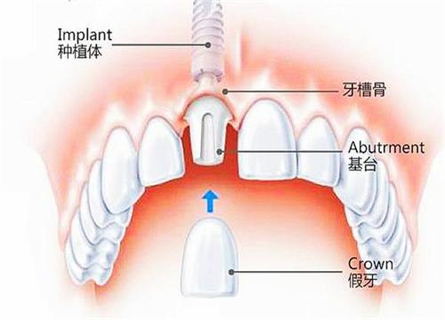 【深圳牙科口腔門診介紹】深圳同源口腔門診部，到底好唔好？