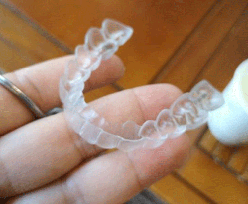 隐形牙齿矫正牙套图