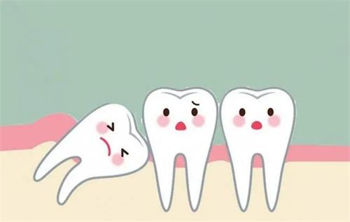 長歪嘅智齒唔拔會頂壞鄰牙嗎？何時該考慮拔牙呢？