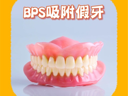香港做吸附性義齒全口價格是多少，分享假牙特點和費用明細！