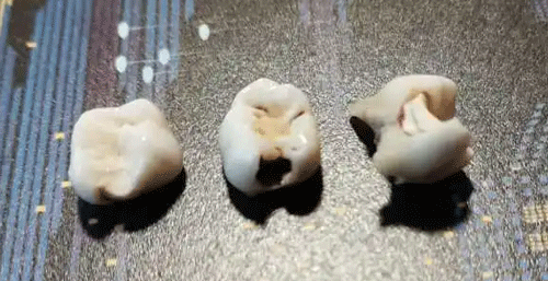 拔掉的坏牙