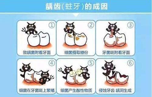 牙醫不會說的補牙後遺癥：深齲修復後疼痛持續超48小時必須復診的真相