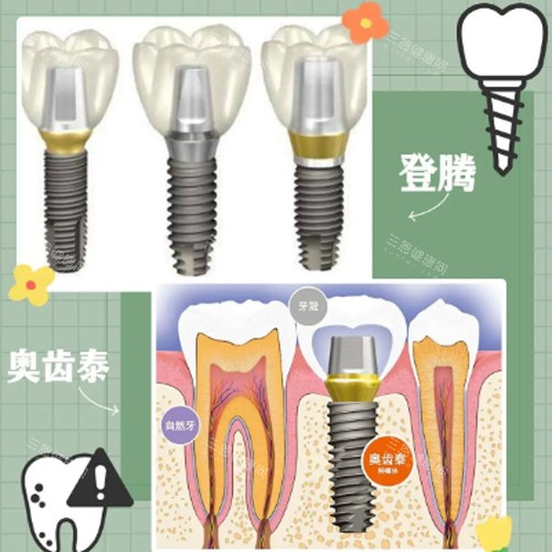 登腾奥齿泰动画图