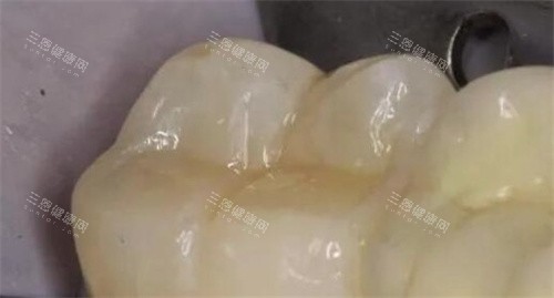 【深圳嘅牙科醫療券應該點樣使用？】手把手教您由申請到報銷嘅全流程!