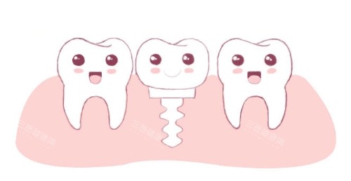 种植牙动画图 种植牙动画图