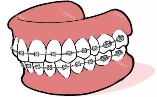 點解港人都中意走去深圳睇牙？皆因價錢親民，交通又方便，服務仲唔錯！