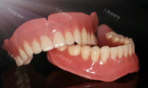 吸附性义齿图片 吸附性义齿图片
