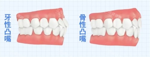 箍牙真係救到嘴凸？連登仔女親測LIHKG熱話3大FAQ