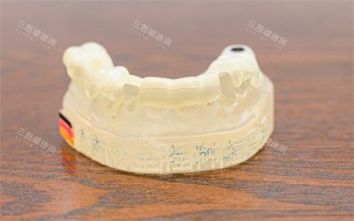 牙齿模具照片