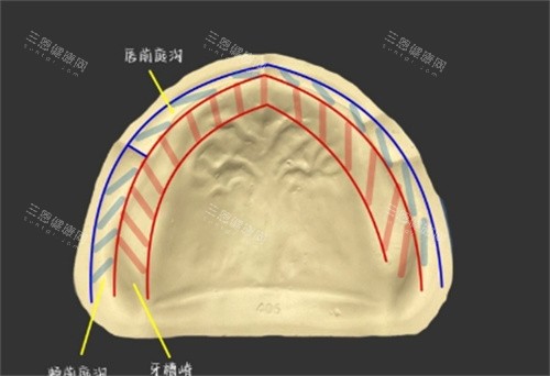 阿伯種牙記：68歲深圳種全口牙$8萬人仔 平過香港幾多？