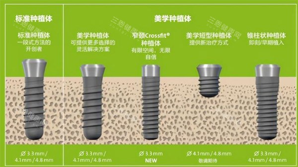 种植体规格种类参考图
