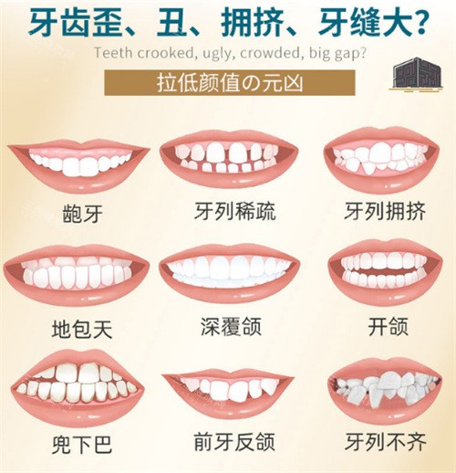 香港人北上深圳睇牙：牙齿矫正费用全揭秘！！！
