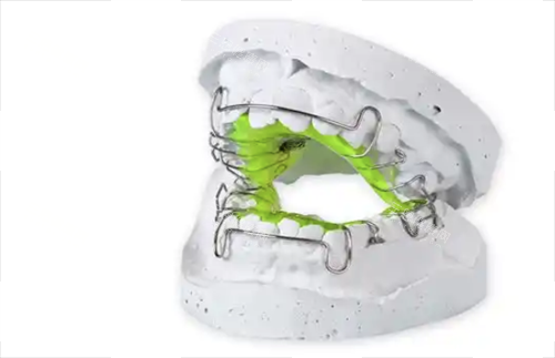 牙齿矫正扩弓器