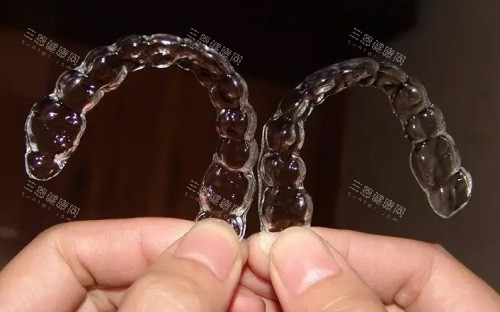 隐形牙套图片