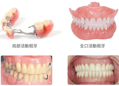 假牙多种方式展示