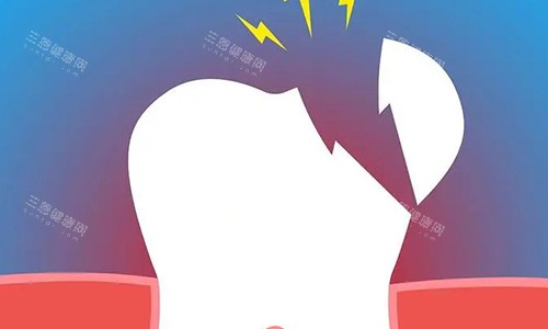 牙齒損壞到咩程度一定要拔？7種拖延唔理分分鐘「連累鄰居」！香港牙醫揭秘保命時機