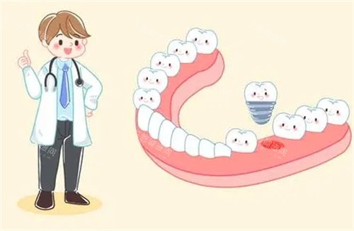 深圳牙科攻略：維港、麥牙、爾睦口腔做種植牙值唔值？