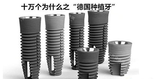 德國abt種植牙比奧齒泰好嗎？從材質、設計到價格6大維度多方面對比