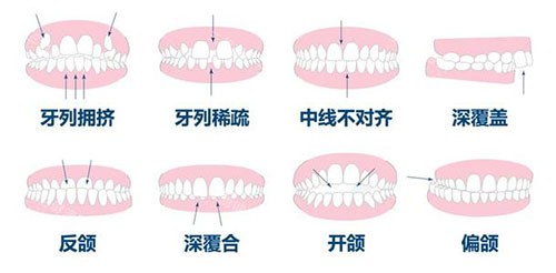 珠海小朋友睇牙要幾多錢？一文睇清兒童牙科治療收費標準！
