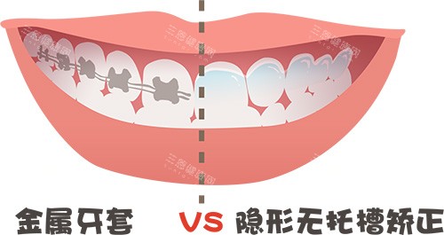 深圳博愛曙光口腔矯牙實測：技術夠硬、價錢抵玩，港人北上整牙新選擇