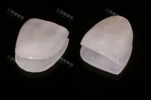 深圳牙科牙貼面價錢全攻略，靚牙唔一定要花大錢！