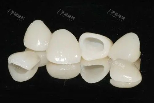 牙齒修復選烤瓷冠定全瓷牙？五大關鍵區別幫你做決定啦！