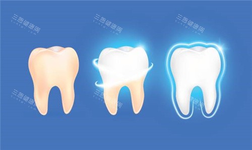 羅湖牙科收費價錢貴不貴？不算貴，文中有植牙|箍牙|兒牙|洗牙等多項目價格