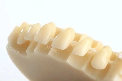牙冠戴久了裡面真牙會壞嗎？一般唔會|前提要正確佩戴牙冠