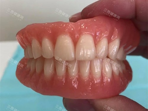 吸附性義齒靠譜嗎？分享價格/維持時間/注意事項點擊了解！