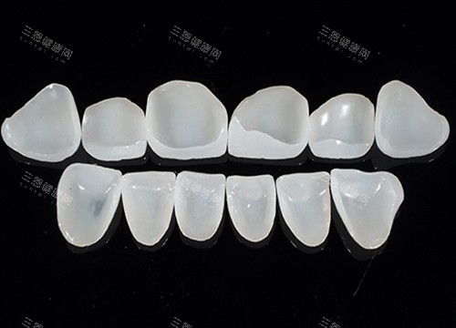 牙齿贴面玻璃陶瓷材料