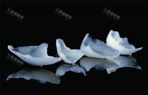 陶瓷貼片只做單顆門牙得唔得？一文拆解可行性同注意事項
