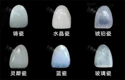 牙贴面材料