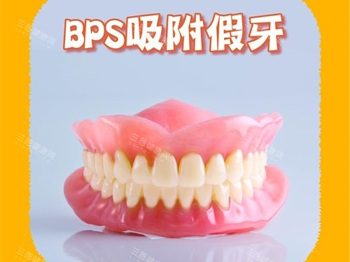 吸附式牙齒是否適合老年人用？牙槽骨扁平患者如何通過精細取模提升舒適度