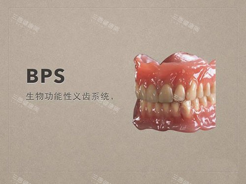 全口吸附性義齒價格貴不貴？分享義齒修復特點和費用明細！