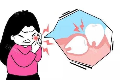 智齿疼痛卡通图