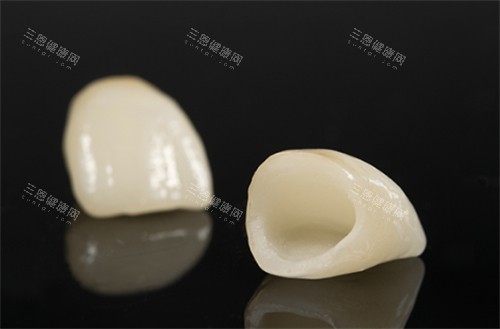 深圳牙冠多少錢壹顆？親身經歷告訴妳真實價目！烤瓷牙500元起、全瓷牙1380元起