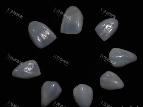 牙齿贴面照片