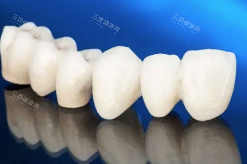 全瓷牙vs金属牙点拣？实验室暴力测试：强度/透光度/牙龈反应3大指标全公开！