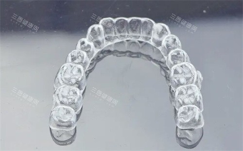可丽尔隐形矫正牙套