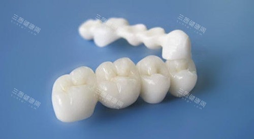 國產全瓷牙價錢大公開！睇埋品牌同優勢，揀對方案唔花冤枉錢