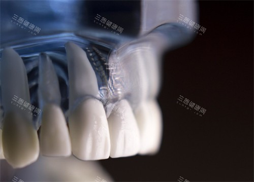 种牙动画图示