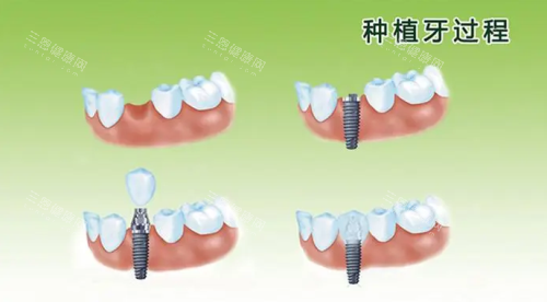 深圳諾德口腔簡介｜從醫資到設備全拆解！正規性實測+羅湖區地址詳細指引