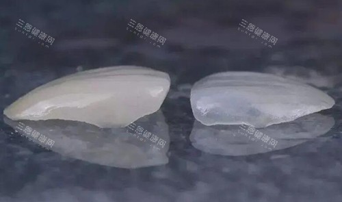 牙齒缺損一小塊怎麼修復？可以通過瓷貼面或嵌體修復，附深圳地區修復費用！