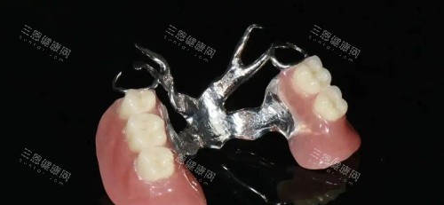 假牙有咩材質？成效同價錢又點樣？長者揀假牙攻略大拆解！
