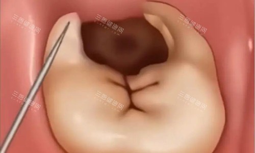 深圳宝妈必藏！边间儿童牙科近啲？会展中心、龙华 ATmall 同梅林虹湾三大院区嘅地址同埋地铁出口详细介绍