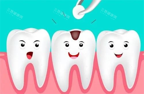 深圳蛀牙深補牙定杜牙根點抉擇?牙醫教睇X光片三指標,附治療流程圖