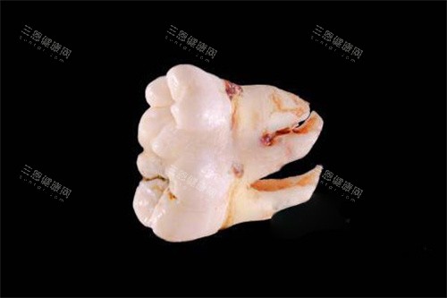 双生牙实物
